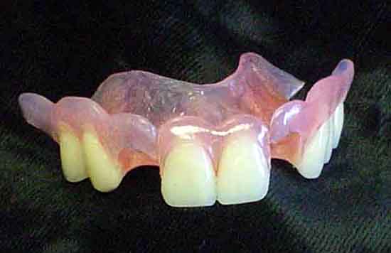 valplast full dentures