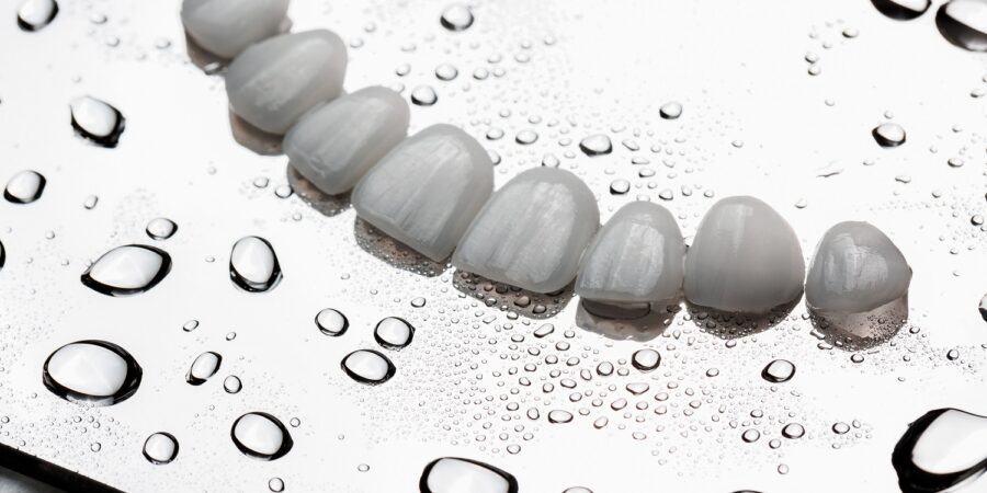 Veneers laid out on a table